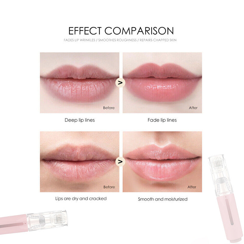 3 In 1 Lip Care Roller Needle Roller Lip My Store